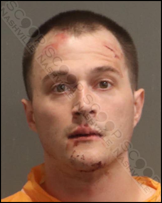 DUI: Matthew Hils crashes car after having 10 drinks at Mickey’s Tavern